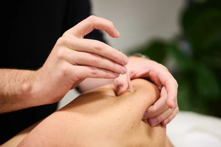 Pure Physio-Queen St-2026_03_28-1167_Andrew-Brady