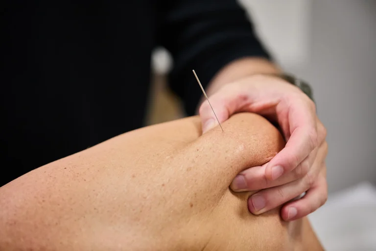 Pure Physio-Queen St-2026_03_28-1182_Andrew-Brady